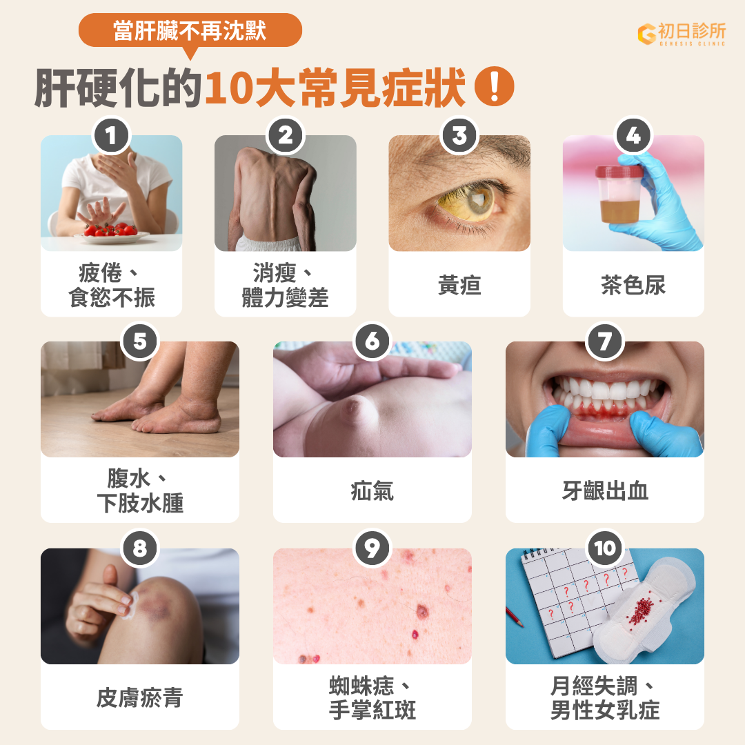 肝臟又被稱為沉默的器官，因為肝臟內部沒有神經，即使肝臟發炎也不會感到疼痛，直到病灶影響到周邊組織或腹膜才會出現症狀，而這往往意味著病情已非常嚴重。 肝硬化的常見症狀包括疲倦、食慾不振、黃疸、腹水合併下肢水腫以及容易出血，如：牙齦出血、皮膚淤青、蜘蛛痣和手掌紅斑等等[Ref]。如果你有啤酒肚合併一些代謝問題，或是已被診斷患有脂肪肝，那一定要特別留意相關症狀，盡快尋求專業醫療協助。