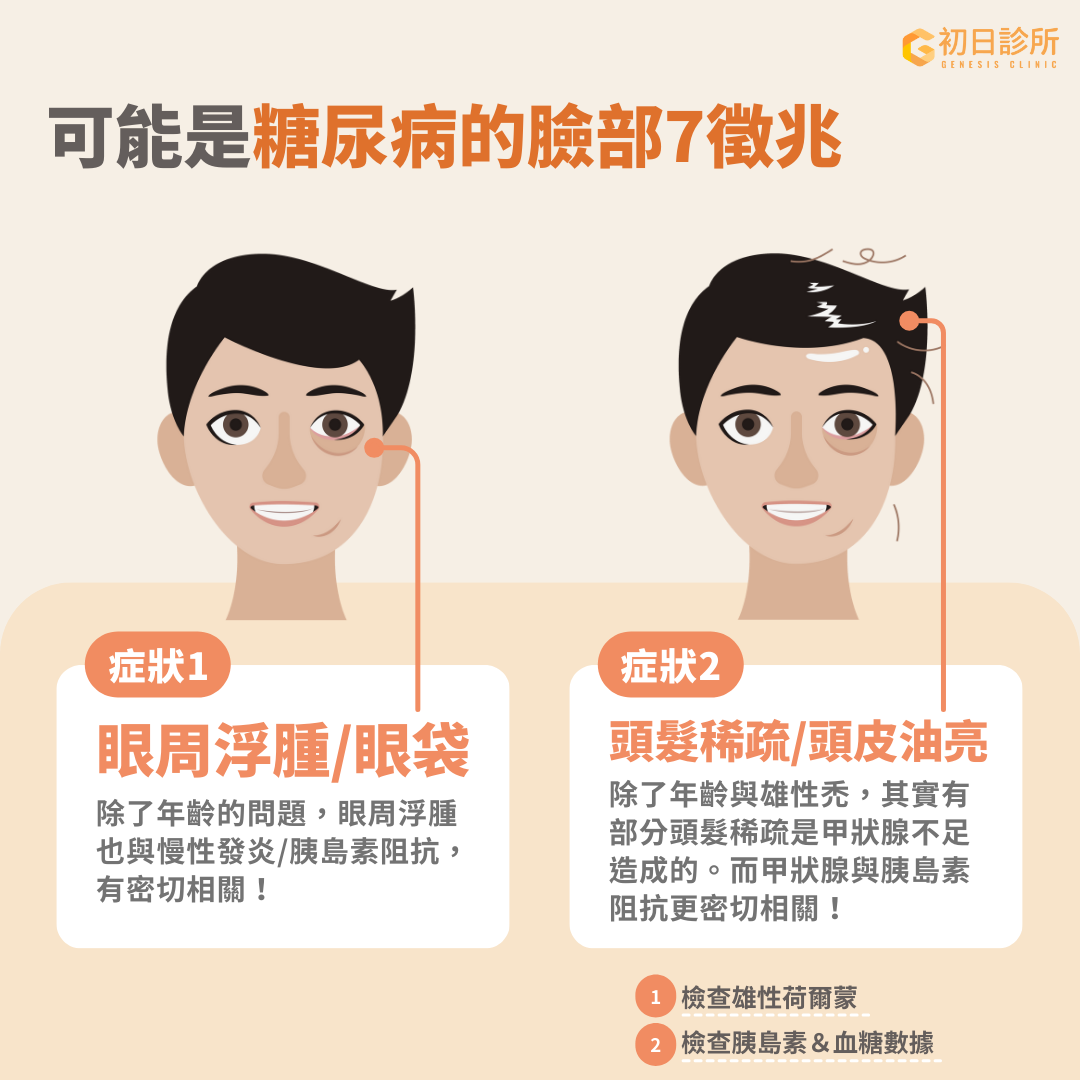 眼周浮腫/出現眼袋、頭髮稀疏都可能是血糖失控的警訊。 眼周浮腫的原因有很多，除了年齡增長外，也可能與慢性發炎或胰島素阻抗相關。 當血糖長期處於不穩定的狀態時，糖尿病患者容易出現眼周浮腫的現象。這是因為長期處於高血糖的狀態下，會損害眼球末端的微血管，這種損害可能使組織液從血管滲出，導致組織腫脹 [ref]。 改善胰島素阻抗後，眼周浮腫常能顯著緩解。儘管年齡增長也會導致眼袋，但若同時伴隨其他症狀，如體重變化、頻繁口渴或疲勞，則應考慮檢查血糖值以排除相關問題。頭髮稀疏的原因不僅與年齡增長或雄性禿有關，也可能是甲狀腺荷爾蒙不足所引起。甲狀腺荷爾蒙在調控細胞功能中扮演著重要角色，包含細胞生長、分化、新陳代謝和熱量生成。當甲狀腺功能異常，會干擾毛髮的生長週期，導致掉髮或生長速度減緩[ref]。 此外，甲狀腺荷爾蒙還與葡萄糖代謝及胰島素阻抗有關 [ref]。當出現頭髮稀疏的症狀時，除了檢查雄性荷爾蒙的濃度，也可以檢查血糖及胰島素濃度，以排除甲狀腺功能失調或糖尿病可能帶來的影響。這樣才能全面評估問題並及早進行調整與治療。