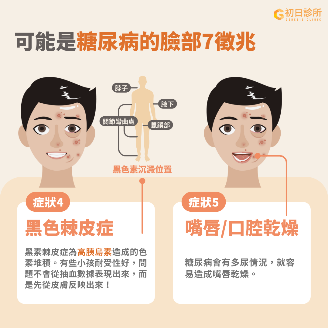  黑色棘皮症、容易口乾舌燥可能都是血糖失控的警訊之一。 黑色棘皮症是一種由高胰島素所引起的皮膚病變，通常表現為皮膚黑色素沉澱、邊界模糊、增厚且粗糙，常見於脖子、腋下或關節彎曲處。 這類皮膚病變多與糖尿病或胰島素阻抗有關 [ref]。臨床上發現，有些兒童即使血糖正常，皮膚卻已出現色素沉澱的現象，這可能是胰島素阻抗的早期警訊！因此，若發現皮膚出現類似變化時，應及時進行糖尿病相關檢查。 而嘴唇/口腔乾燥也是糖尿病患者的常見症狀之一，主要由多尿導致的脫水和唾液腺功能受損引起。此外，糖尿病（葡萄糖濃度升高）還會影響唾液腺功能，使唾液變的黏稠，最終導致口乾。 這種情況與高血糖引起的脫水和自主神經病變相關。當血糖控制不佳，糖化血色素（HbA1c）數值升高時，口乾症狀會更加明顯 [ref]。若您長期感到口乾，建議儘早檢查血糖，以評估是否與糖尿病相關！