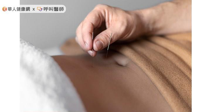 丹田灸也是一個很好提升腎氣跟化解痰濕瘀血的治療。