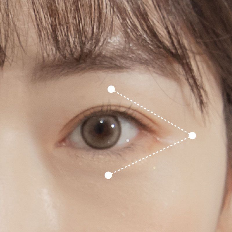 美眼儀可用於眼袋、眼周